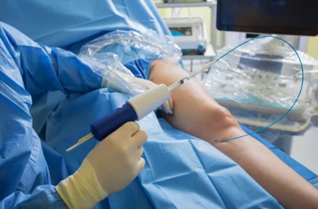 Czym zajmuje się lekarz flebolog i jak może pomóc w chorobach żył