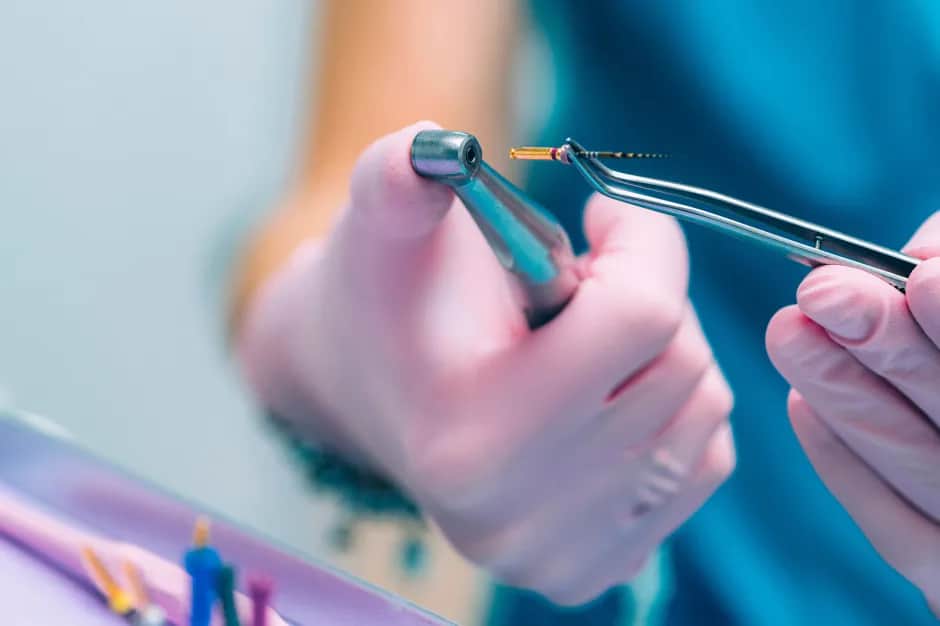 Ile kosztuje leczenie kanałowe na NFZ? Co musisz wiedzieć o kosztach?