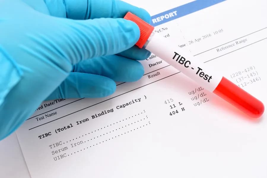 Badanie TIBC co to jest i jak może uratować Twoje zdrowie